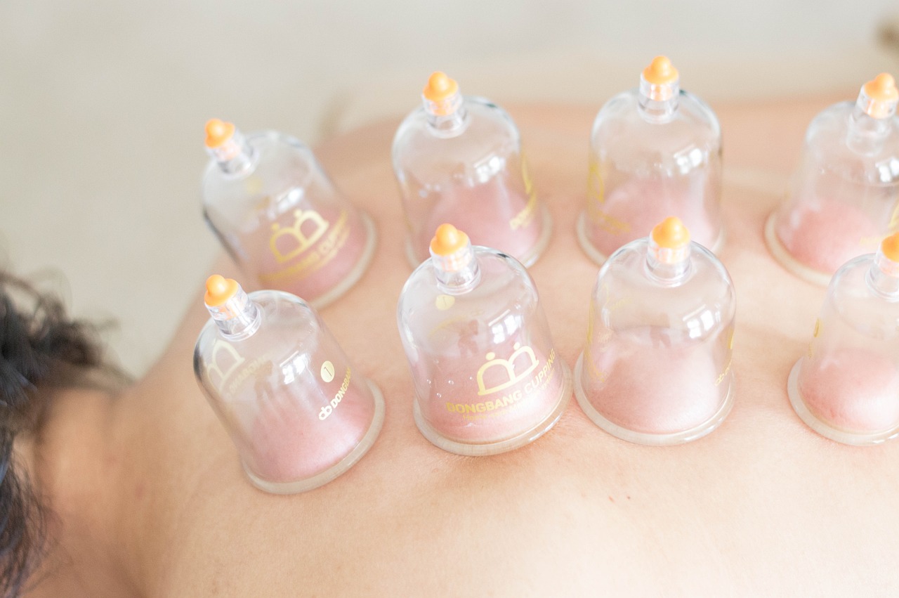 Cupping Therapy Photo